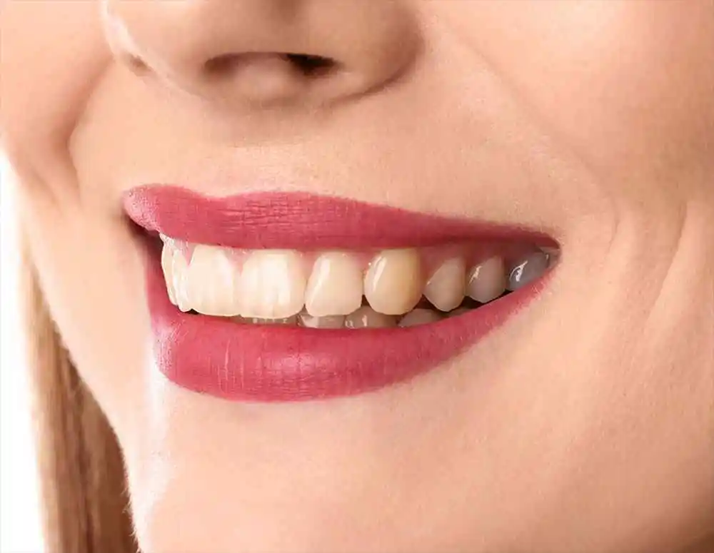 Paciente joven bonita con dientes hermosos antes del blanqueamiento dental
